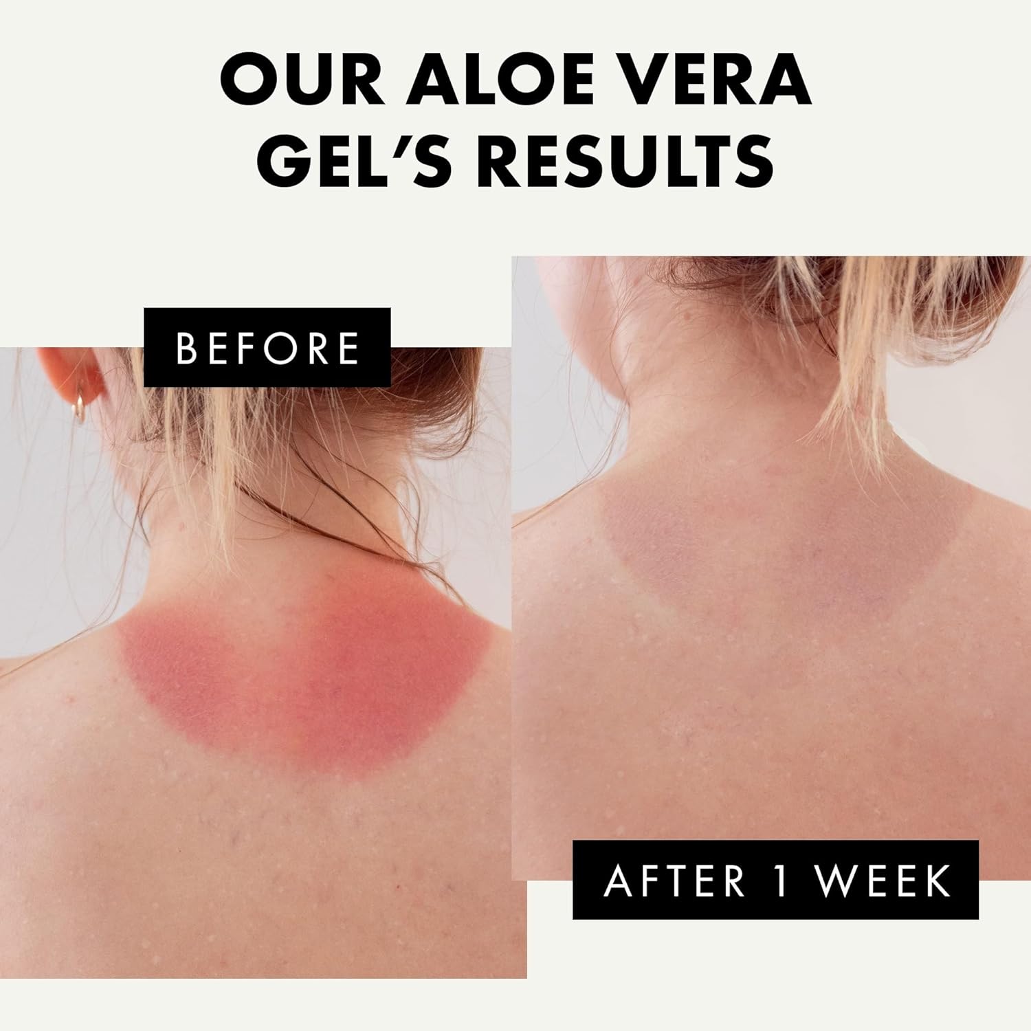 Pure Aloe Vera Gel for Face, Hair & Body - 100% Natural Organic Aloe Vera Gel for After Sun Skin Care, Soothing, Hydrating - Hand Harvested & Cold Pressed in Australia - Dermatologist Developed-1