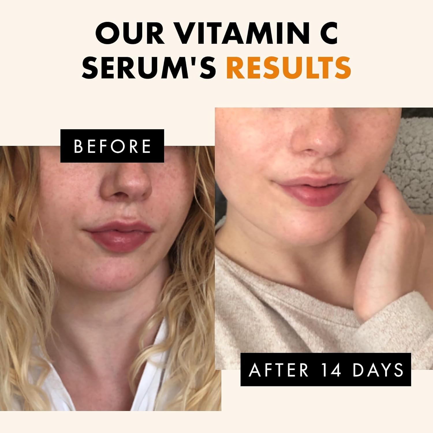 Vitamin C Face Serum - Hyaluronic Acid, Retinol, & Vit E - Anti Aging Facial Brightening Serum for Skin Care - Timeless Pure Vitamin C Serum for Face Dark Spots, Vit C Serum Oil, Face Serum for Women-2