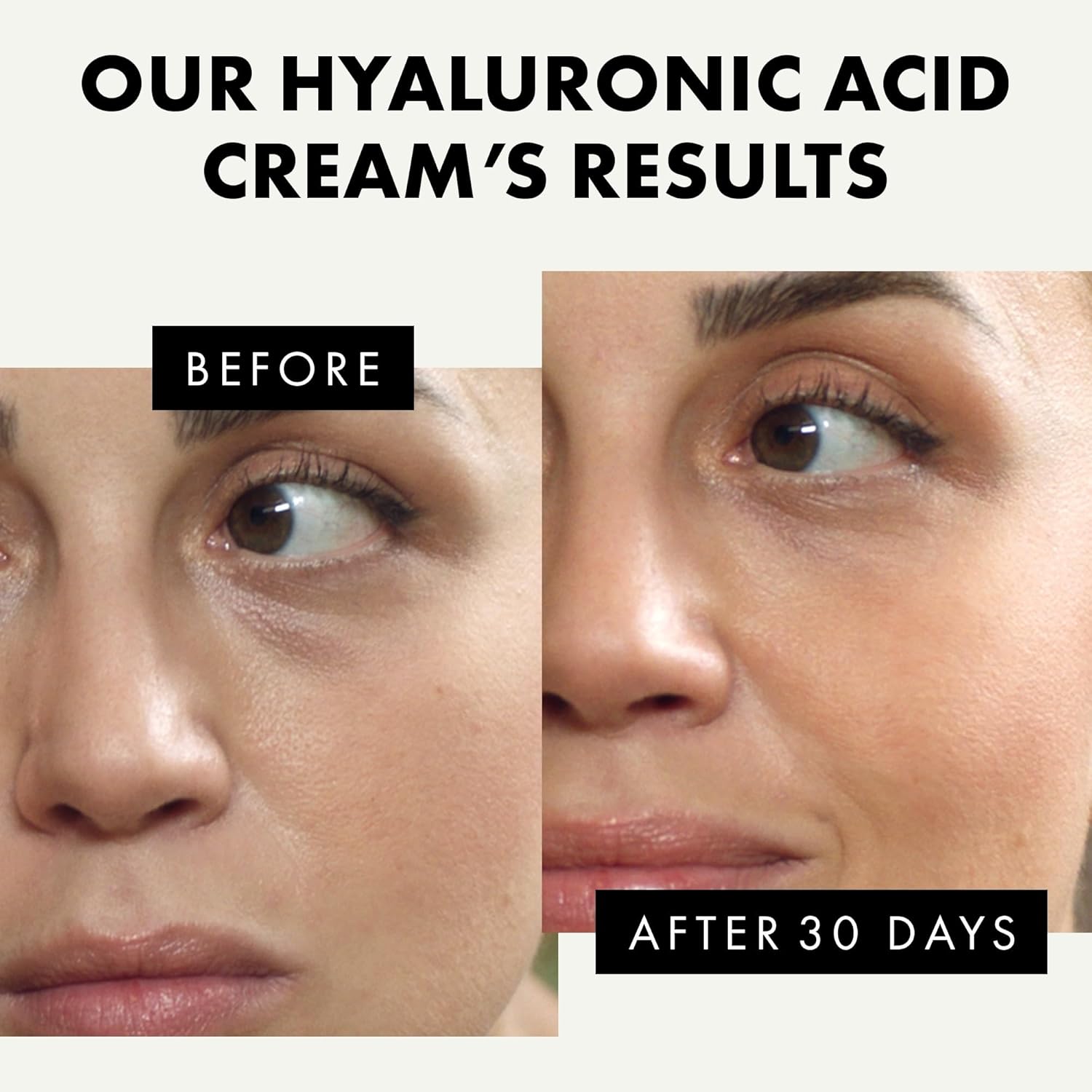 Hyaluronic Acid Face Cream - Hyaluronic Acid with Retinol, Vitamin C & E - Hydrating Face Cream, Anti Aging Hyaluronic Acid Moisturizer, Hyaluronic Acid Cream for Sensitive Skin-2