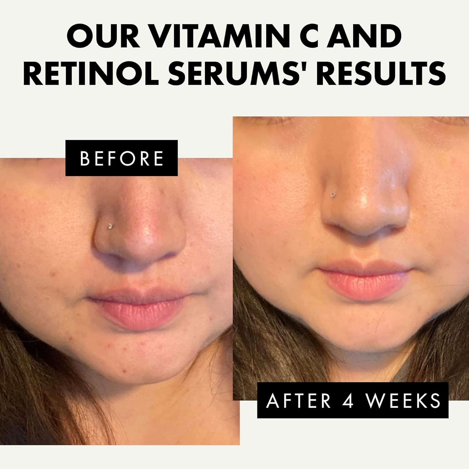 2 Facial Serum - Vitamin C and Retinol Serum for Face, Anti Aging Serums for Skin Care - Boosts Collagen, Reduce Fine Lines & Wrinkles and Restore Skin Vibriance, Day & Night Serum for Face-2