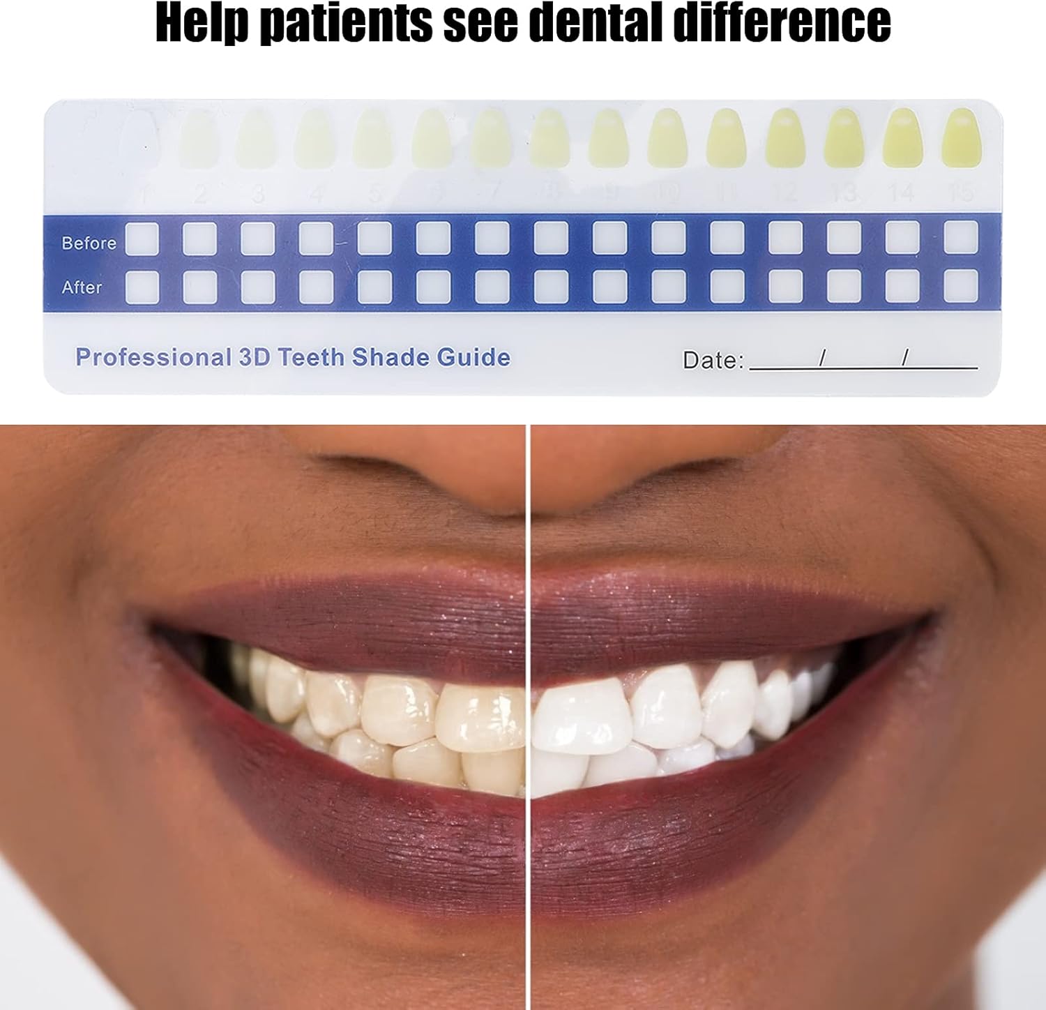 5 Pack Paper Teeth Shade Guide Whitening Comparing Shade Chart, Household Teeth Color Chart Tooth Shade Chart Comparing Card Household Oral Care Supplies for Dentist-1