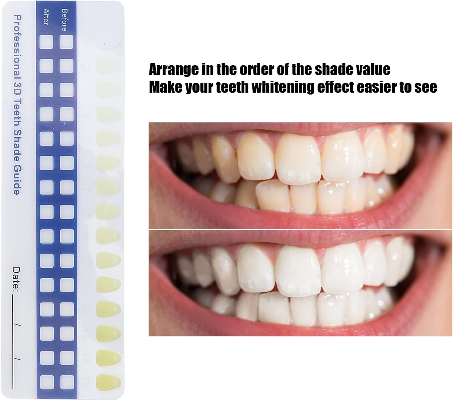 5 Pack Paper Teeth Shade Guide Whitening Comparing Shade Chart, Household Teeth Color Chart Tooth Shade Chart Comparing Card Household Oral Care Supplies for Dentist-2