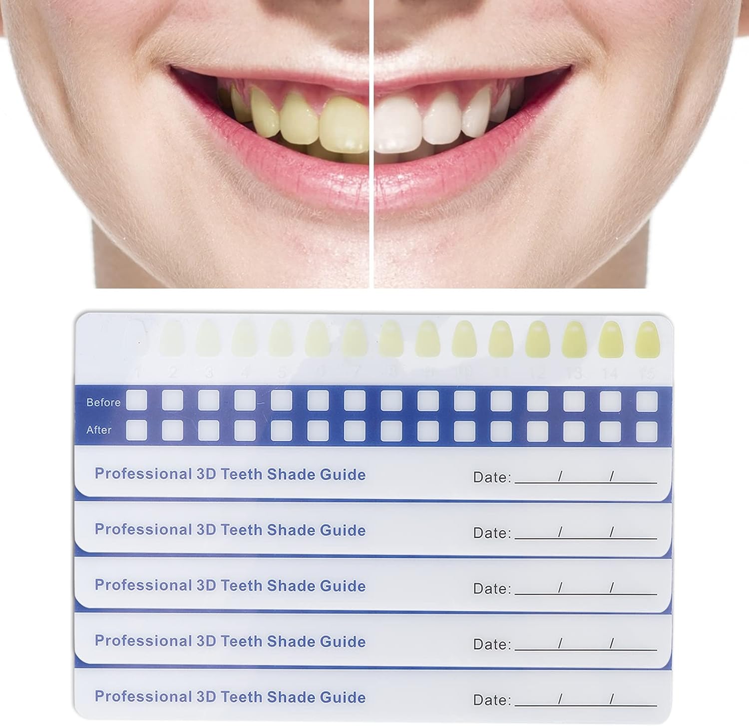 5 Pack Paper Teeth Shade Guide Whitening Comparing Shade Chart, Household Teeth Color Chart Tooth Shade Chart Comparing Card Household Oral Care Supplies for Dentist-3