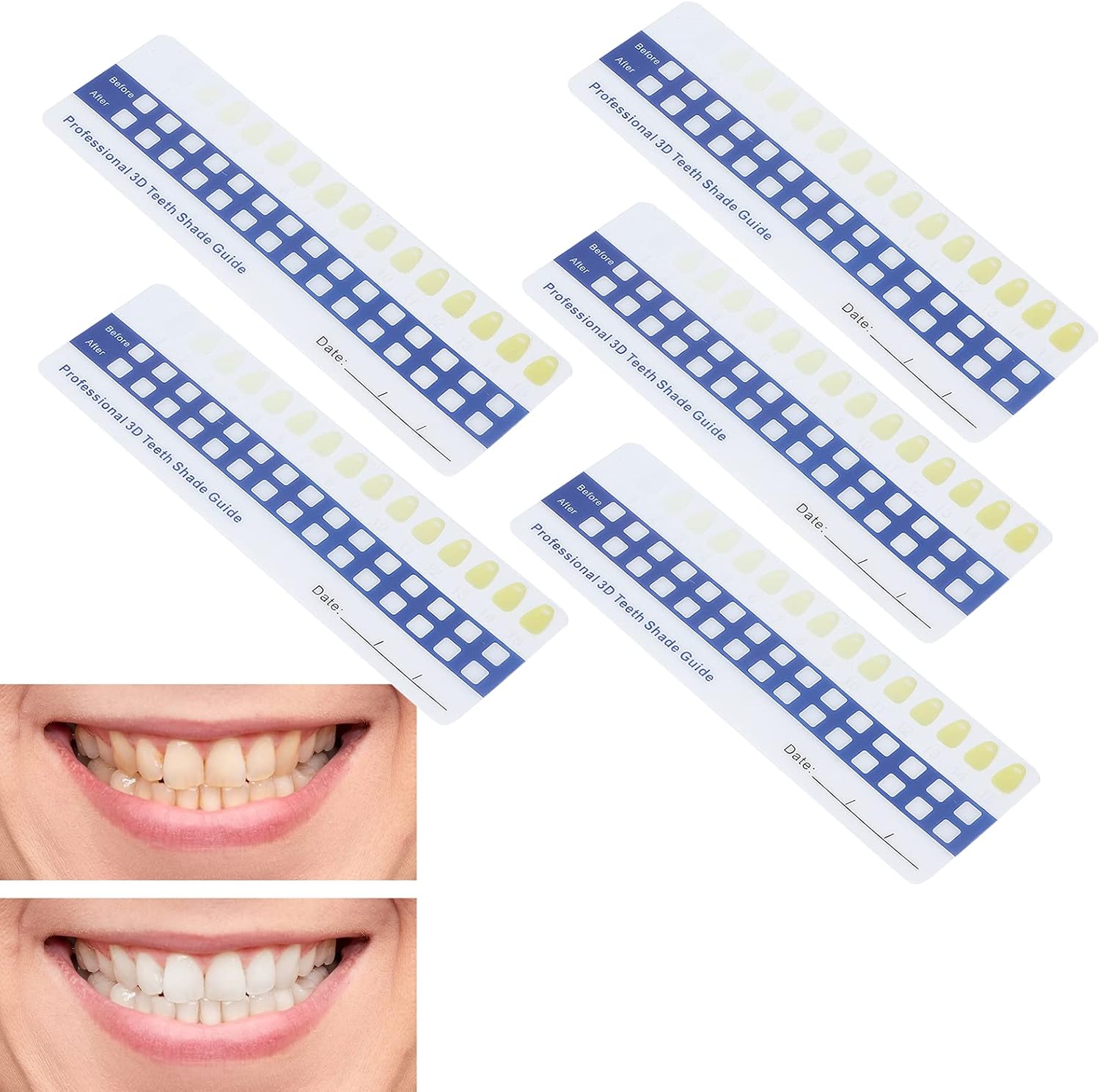 5 Pack Paper Teeth Shade Guide Whitening Comparing Shade Chart, Household Teeth Color Chart Tooth Shade Chart Comparing Card Household Oral Care Supplies for Dentist-5