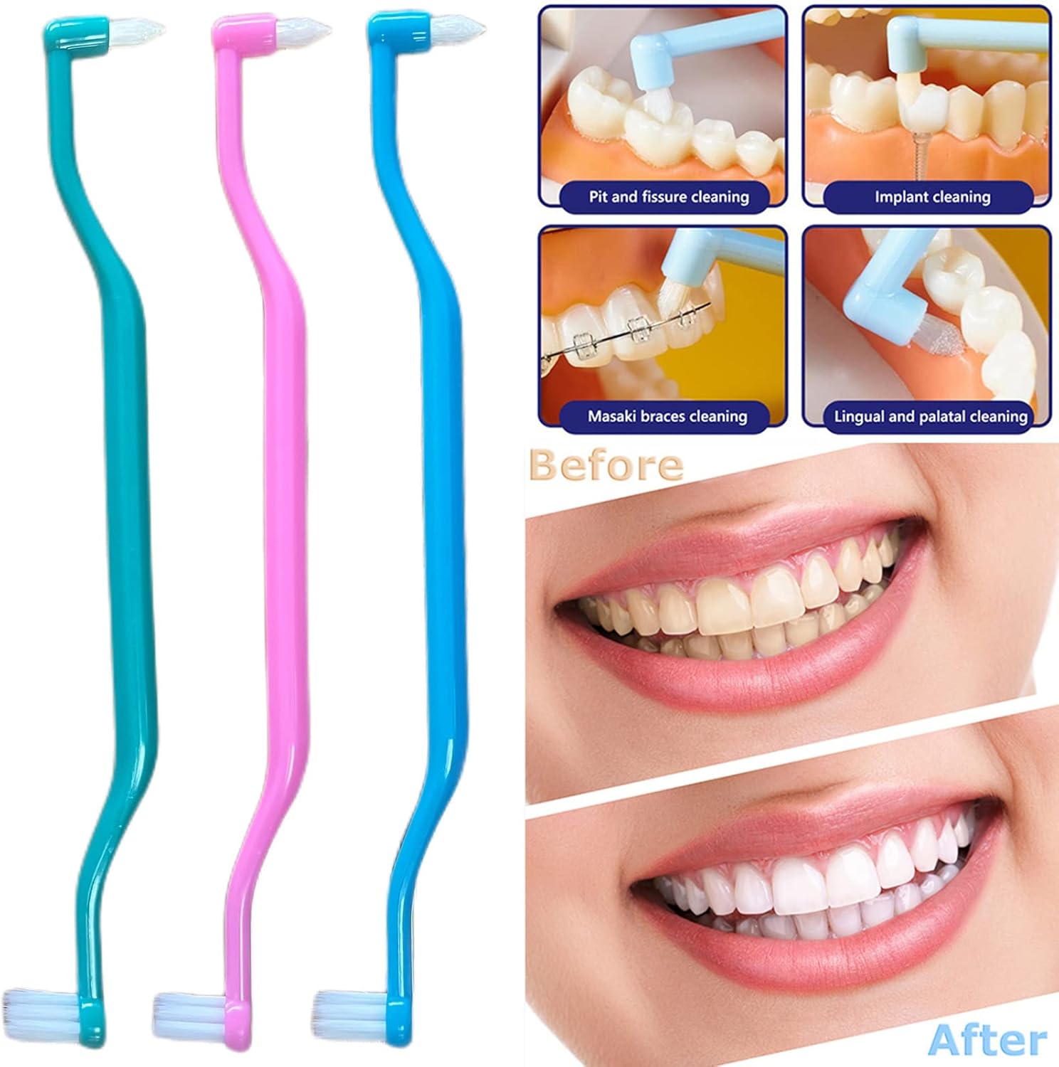 6 Pieces 2-in-1 Toothbrush with Interdental and Wisdom Teeth Brush Heads for Comprehensive Oral Care, Soft Single Interdental Brushes Between Teeth Wisdom Toothbrush for Braces-3