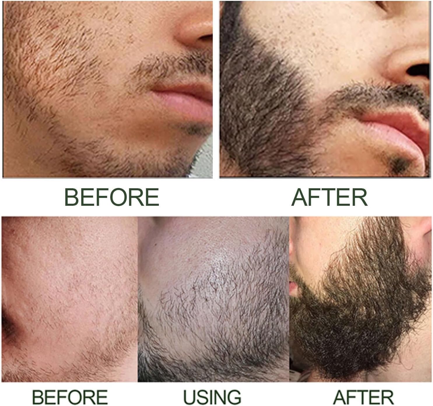 Beard Growth Kit-With Beard Derma Roller For Growth & Natural Ingredients Beard Growth Serum-Beard Grooming Kit For Men-Beard Kit For for Beard Rapid Growth and Thickening -Gifts For Men Dad Father-8