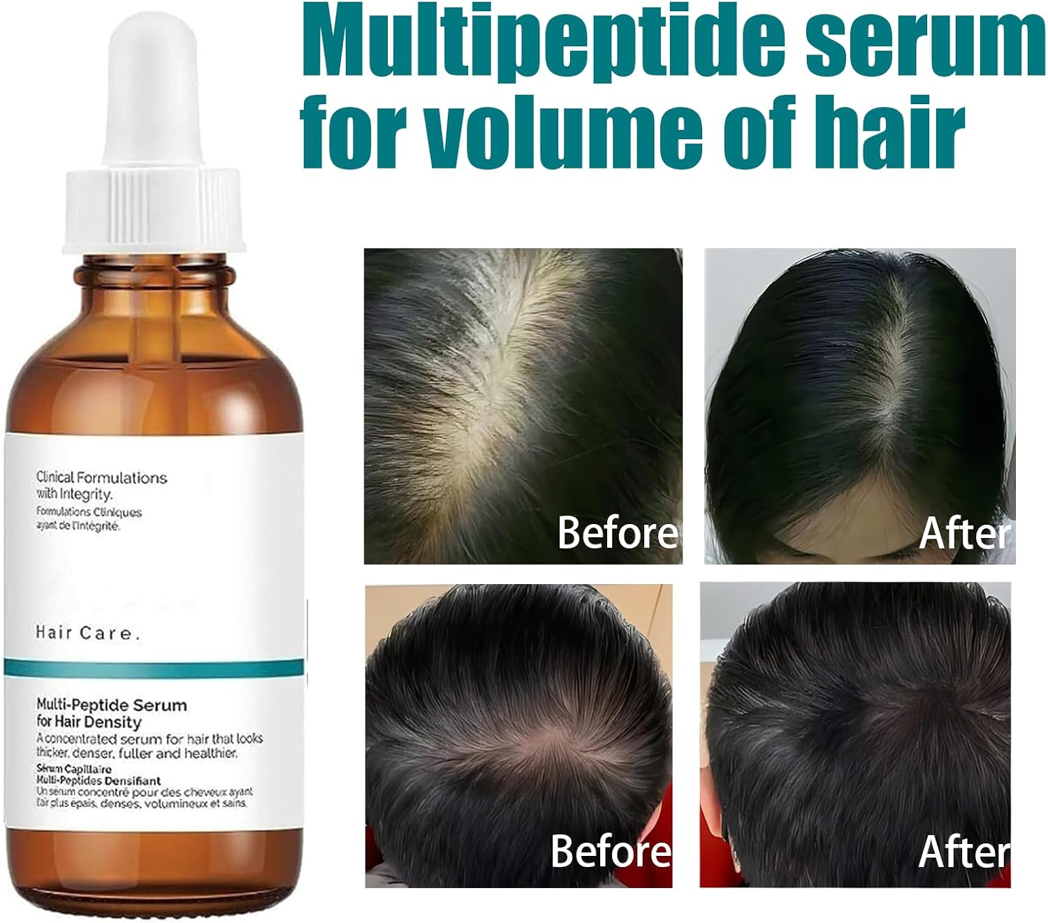 Hair Growth Serum,Multi-Peptide Hair Growth Serum,Hair Serum,Multi-Peptide Hair Serum For Hair Growth Scalp Serum Hair Care Oil,Denser And Fuller Looking Hair 1pcs-5