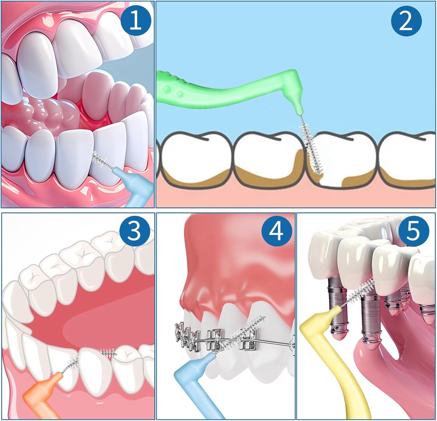 RAYITO 50pcs Interdental Brushes, 5 Sizes Soft Dental Brushes with Non-Slip Handle Angled Head Tooth Picks Floss Sticks Dental Floss Brushes for Braces Oral Cleaning Narrow Gaps Between Teeth-3