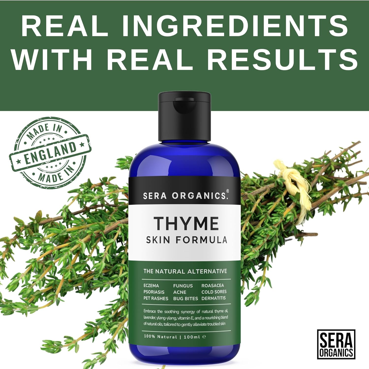 Thyme Oil Blend - For Eczema, Psoriasis, Dermatitis, Rosacea & Cold Sores - Soothes Itching & Irritation Suitable for Sensitive Skin Made In The UK (100ml) All Natural By Sera Organics-2