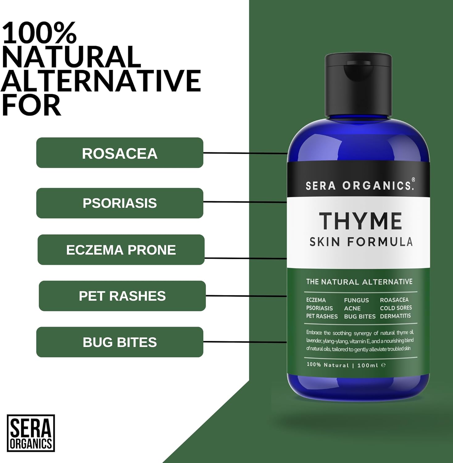 Thyme Oil Blend - For Eczema, Psoriasis, Dermatitis, Rosacea & Cold Sores - Soothes Itching & Irritation Suitable for Sensitive Skin Made In The UK (100ml) All Natural By Sera Organics-3