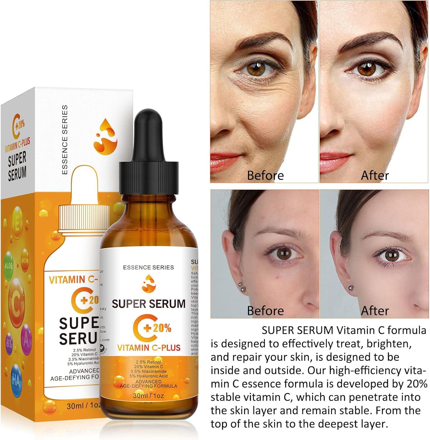 20% Vitamin C Serum for Face with Hyaluronic Acid & Retinol Serum, 30ML Natural Anti Aging & Wrinkle Facial Serum, Boost Skin Collagen, Hydrate Brighten Plump Skin (30ml)-4