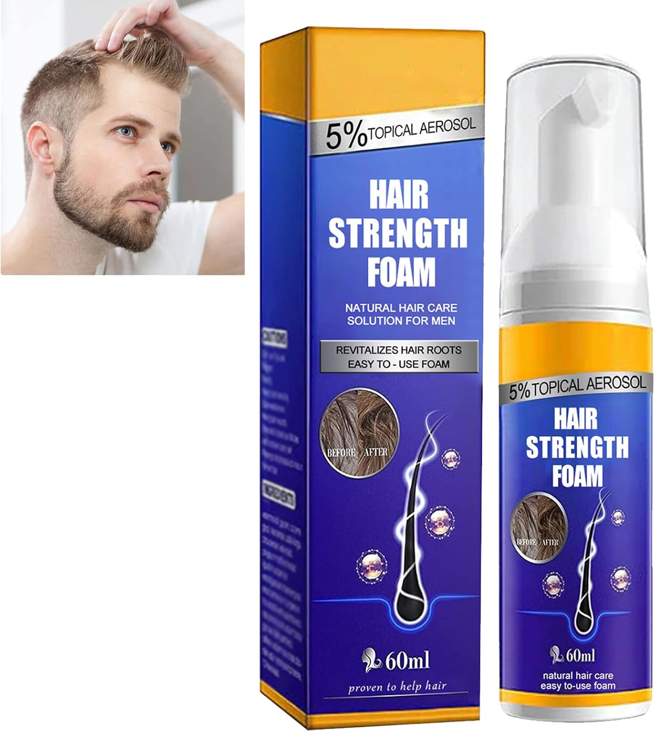 KOAHDE Hair Regrowth Foam for Men,Hair Regrowth Spray Foam,Hair Growth Foam,Anti Hair Loss Foam,Thinning Hair Foam for Men,Hair Regrowth Treatment for Men,Hair Growth Serum for Men,Hair Loss Serum-0