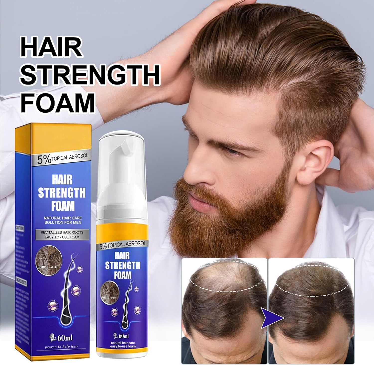 KOAHDE Hair Regrowth Foam for Men,Hair Regrowth Spray Foam,Hair Growth Foam,Anti Hair Loss Foam,Thinning Hair Foam for Men,Hair Regrowth Treatment for Men,Hair Growth Serum for Men,Hair Loss Serum-1