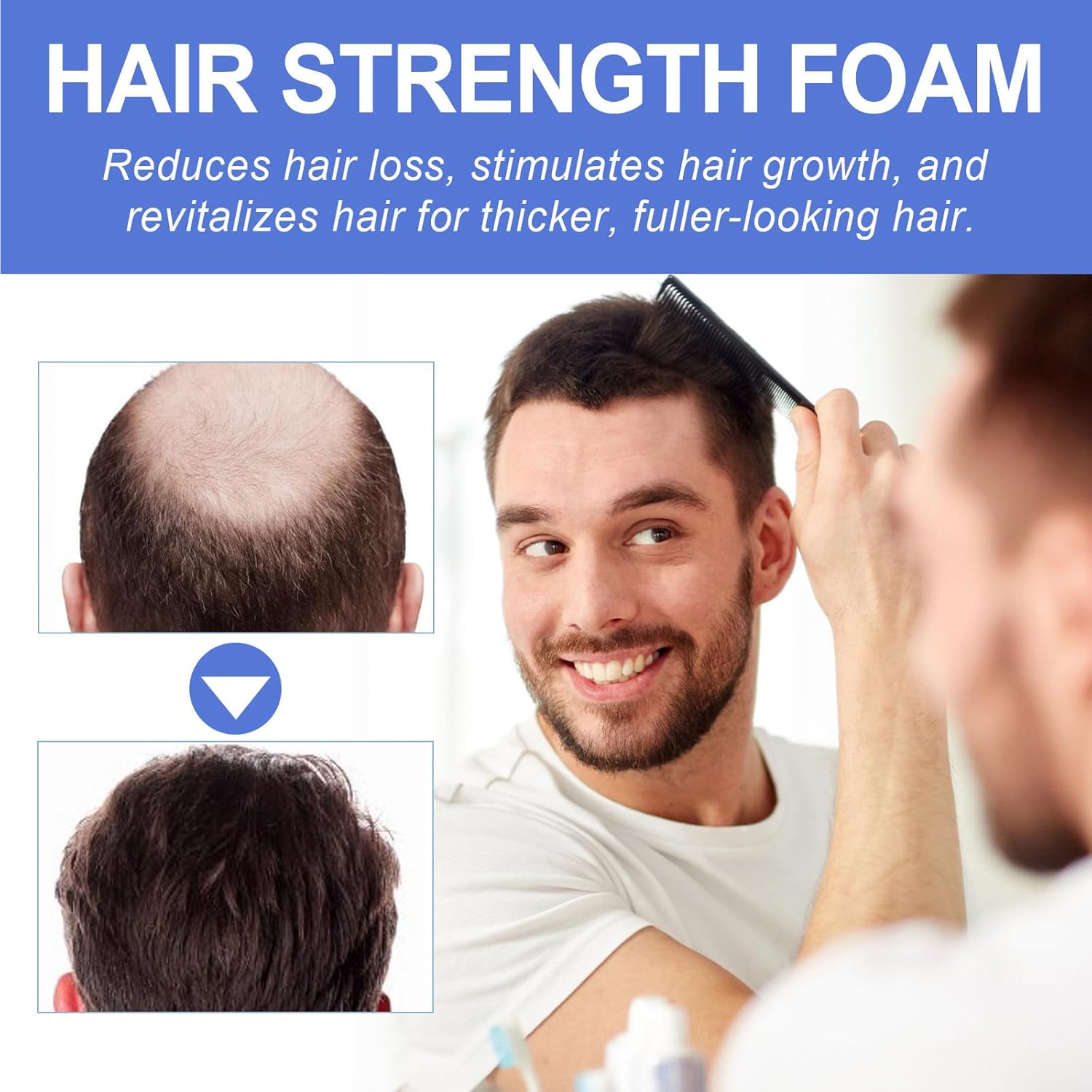 KOAHDE Hair Regrowth Foam for Men,Hair Regrowth Spray Foam,Hair Growth Foam,Anti Hair Loss Foam,Thinning Hair Foam for Men,Hair Regrowth Treatment for Men,Hair Growth Serum for Men,Hair Loss Serum-3