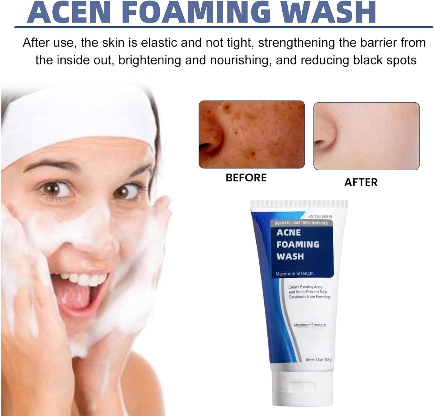 Acne Foam Wash,Acne Foaming Wash,Mild Daily Facial Cleanser for Deep Pore Cleansing,Face Wash Women,Mild Cleansing,Cleansing Foam,Exfoliating Face Wash,Foaming Cleanser,Facial Wash,Cleansing Foam-7