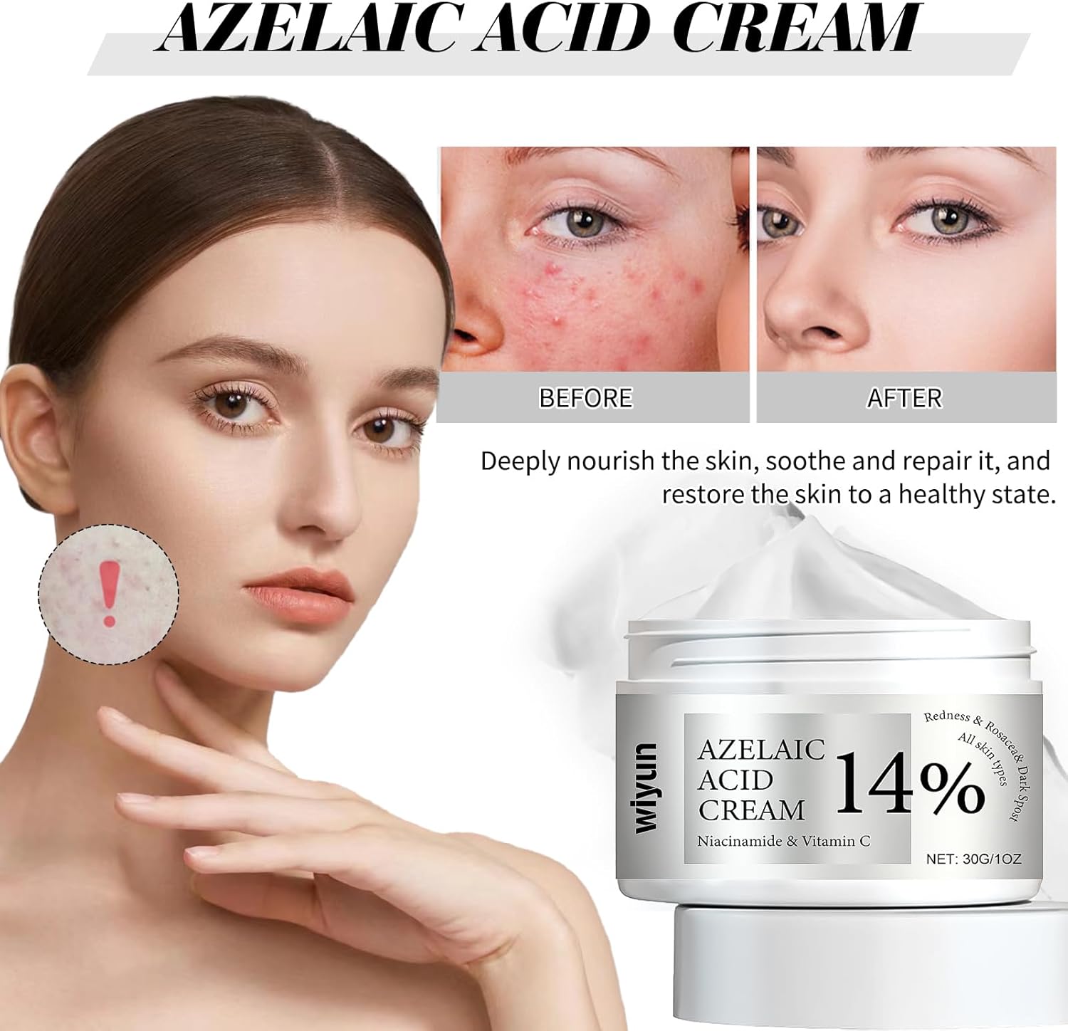 Azelaic Acid Cream 2pcs,14% Azelaic Acid Serum Face Cream,Azelaic Acid Serum Cream Niacinamide & Vitamin C,Shrinking Pores and Reducing Blemishes,Suitable for All Skin Types-1