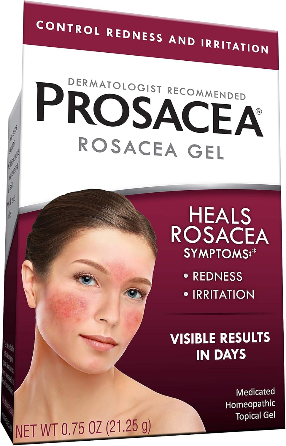 Prosacea Controls Maskne Rosacea Symptoms of Redness, Pimples & Irritation, 0.75 Oz-0