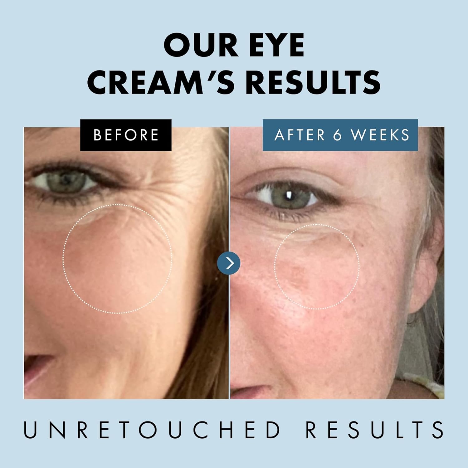 Under Eye Cream for Dark Circles and Puffiness - Eye Repair Cream Dark Circles Under Eye Treatment - Eye Cream Anti Aging Under Eye Serum Moisturizer Puffy Eyes Treatment Dark Circle-3