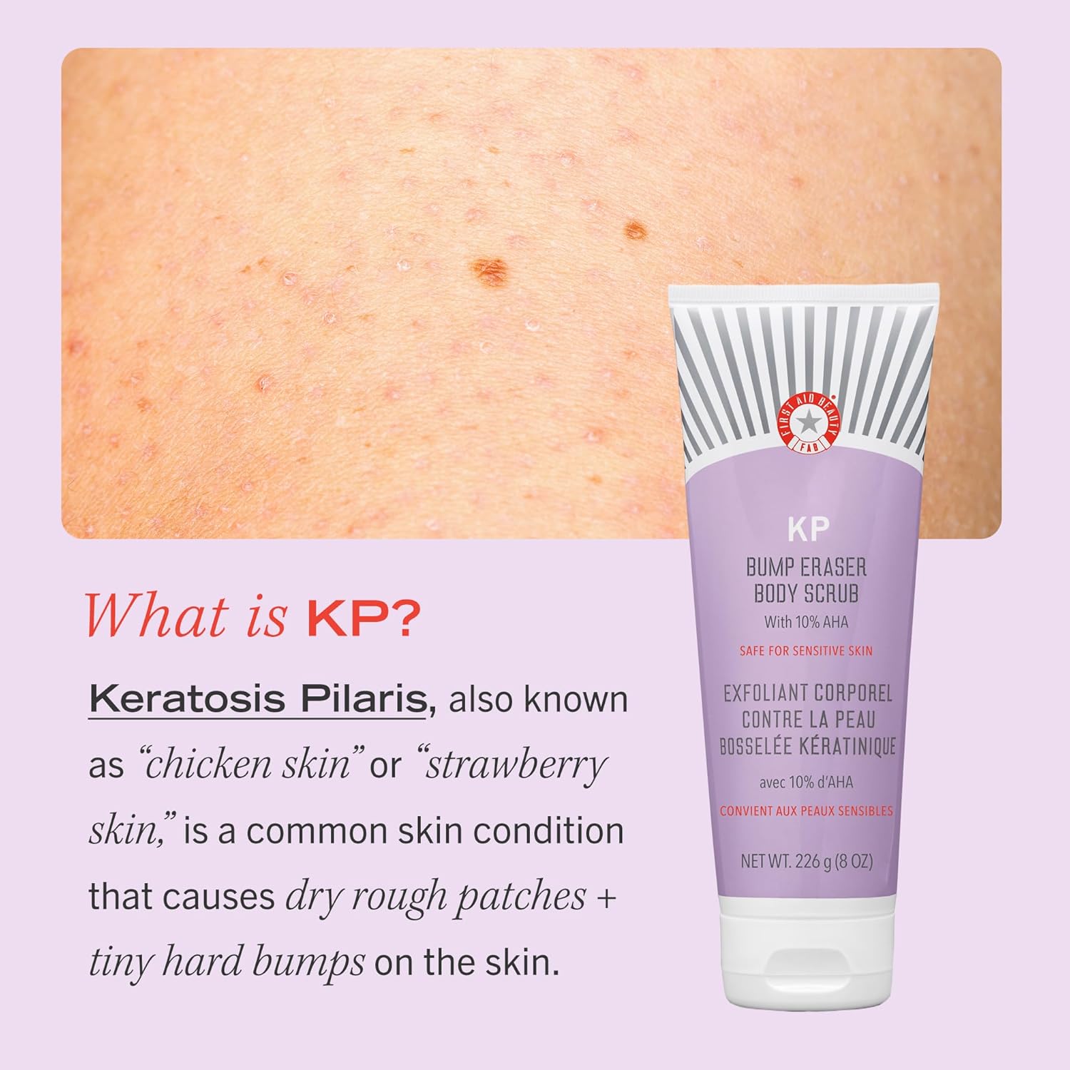 First Aid Beauty KP Bump Eraser Body Scrub Exfoliant for Keratosis Pilaris with 10% AHA 4 oz.-5