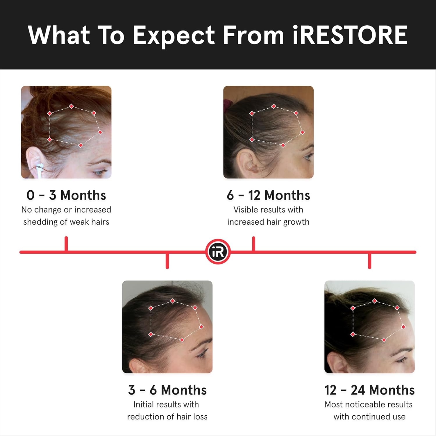 iRestore Professional Laser Hair System - FDA Cleared Hair Growth Cap for Men and Women with Thinning Hair or Hair Loss-4