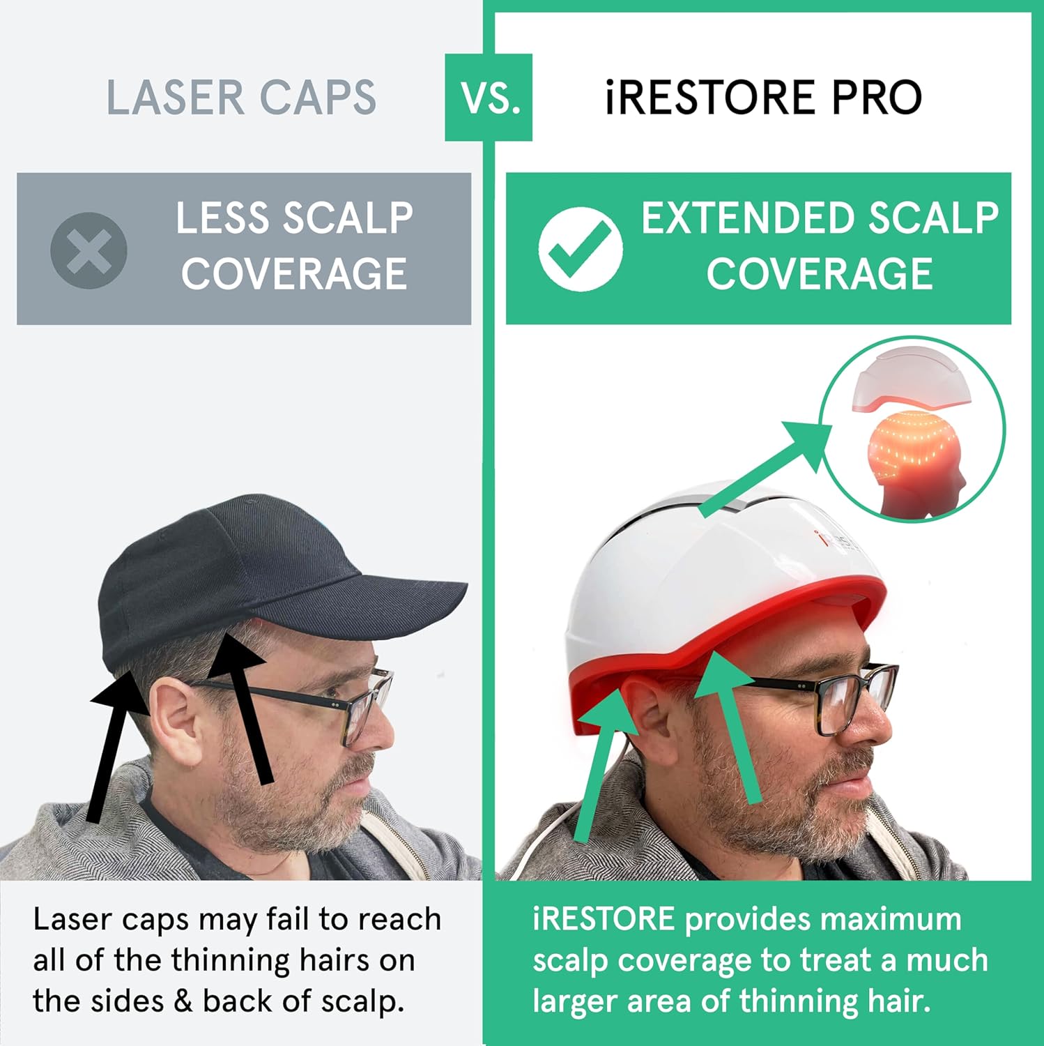 iRestore Professional Laser Hair System - FDA Cleared Hair Growth Cap for Men and Women with Thinning Hair or Hair Loss-6