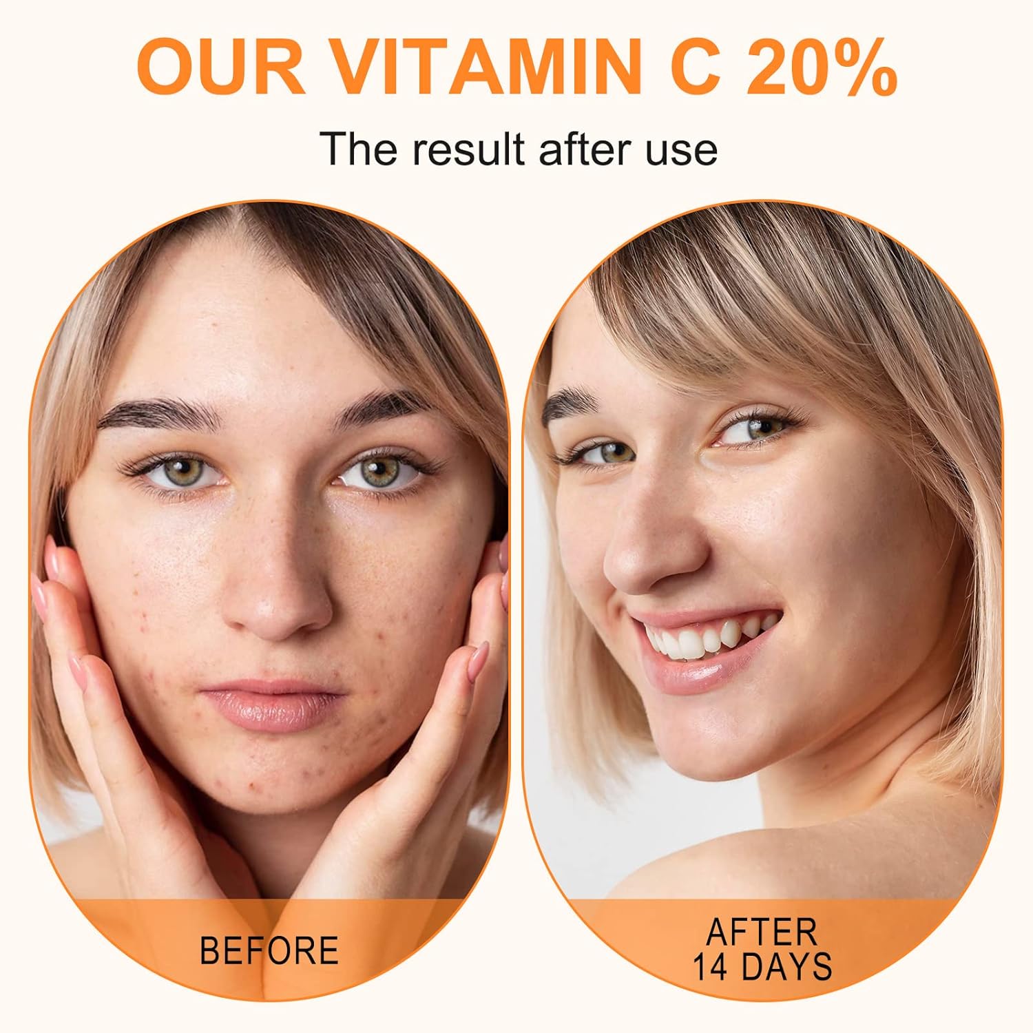 Premium 20% Vitamin C Serum For Face with Hyaluronic Acid, Retinol & Amino Acids - Boost Skin Collagen,Hydrate & Plump Skin, Anti Aging & Wrinkle Facial Serum 60ml-4