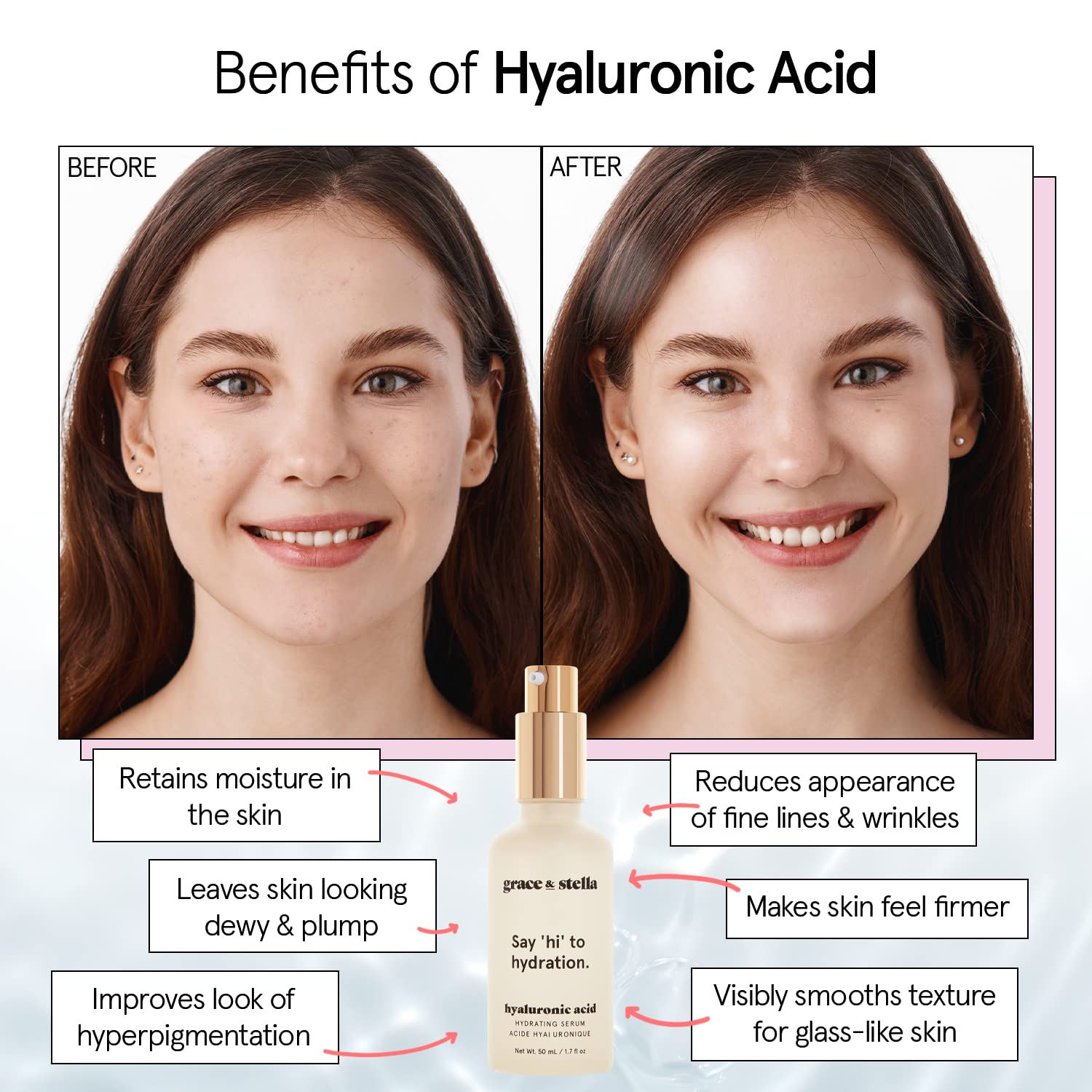 grace & stella Award Winning Hyaluronic Acid Serum (50ml/1.7 fl oz) Hyaluronic Acid Serum for Face - Acido Hialuronico Face Serum for Women - Hydrating Serum Remove Fine Lines, Wrinkles - Anti Aging-2