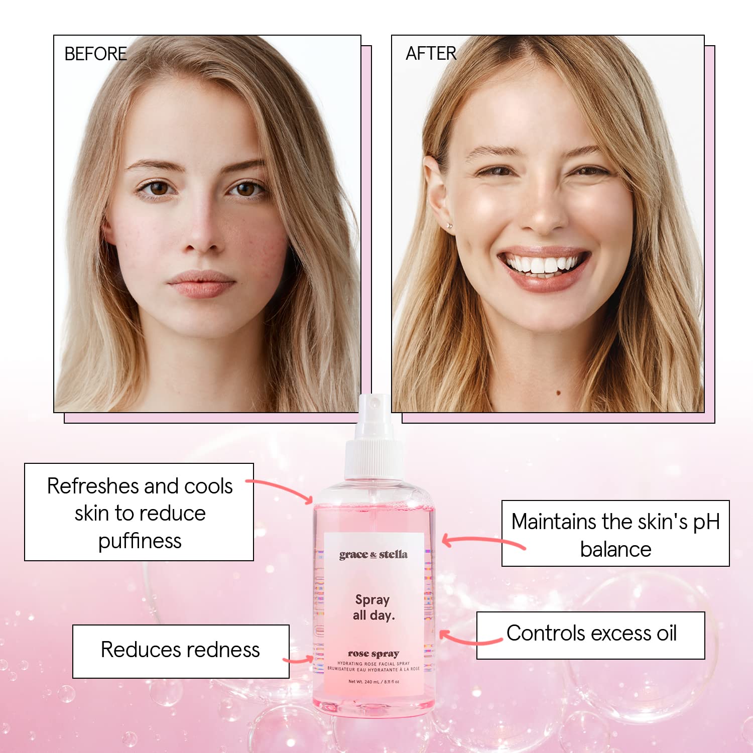 grace & stella Award Winning Rose Water Facial Spray (30ml) - Vegan - Rose Water Spray Toner for Face - Rose Spray Facial Mist - Rosewater Spray Rose Hydrosol-2