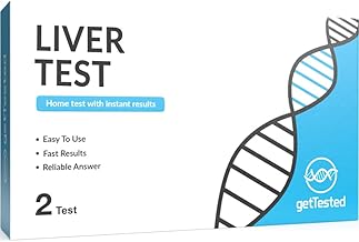 Liver Test (1 Test) Urine-Based Liver Function Test Provides immediate Results, It detects Bilirubin and urobilinogen, Reflecting Their Blood Concentration, for an Accurate Liver Health Assessment.