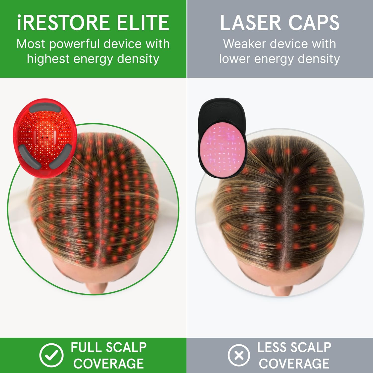 iRestore Elite - Laser Red Light Therapy for Hair Growth System - FDA Cleared Hair Loss, Hair Thinning & Alopecia Treatment for Men & Women - Laser Cap for Hair Regrowth Stimulates Denser Fuller Hair-3