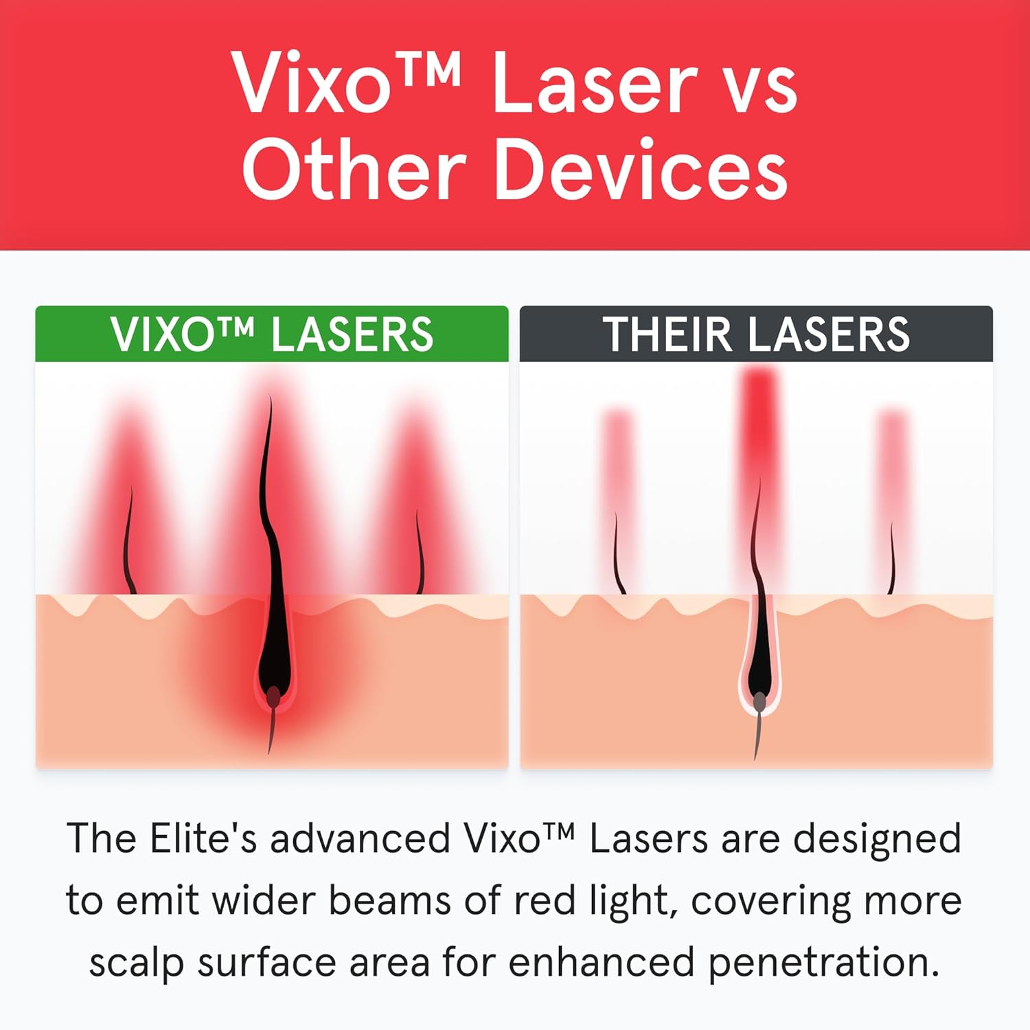 iRestore Elite - Laser Red Light Therapy for Hair Growth System - FDA Cleared Hair Loss, Hair Thinning & Alopecia Treatment for Men & Women - Laser Cap for Hair Regrowth Stimulates Denser Fuller Hair-5