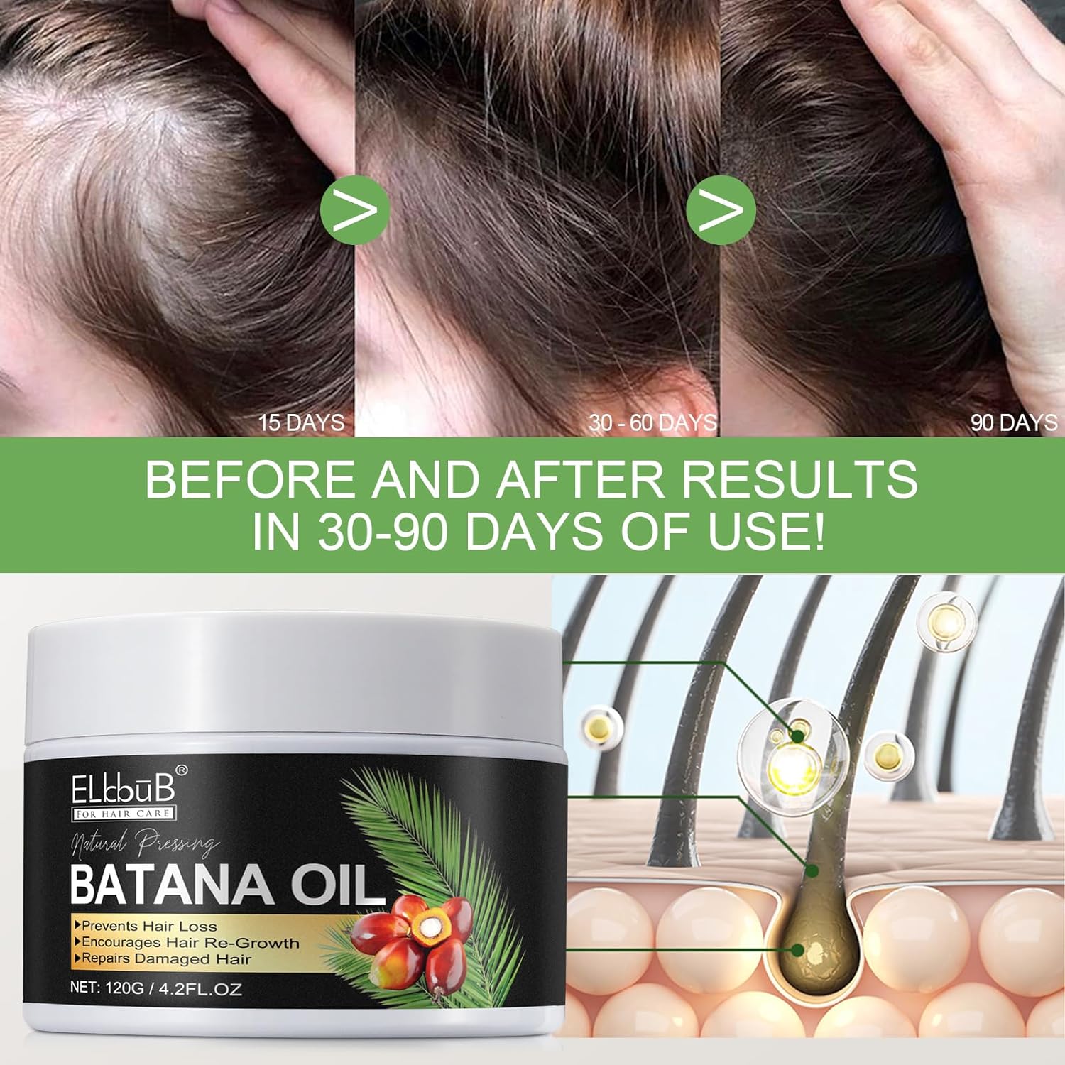 Raw Batana Oil for Hair Growth and Repair -100% Pure, Unrefined Oil from Honduran Rainforests Prevent Hair Loss and Enhances Hair Thickness in Men & Women-4