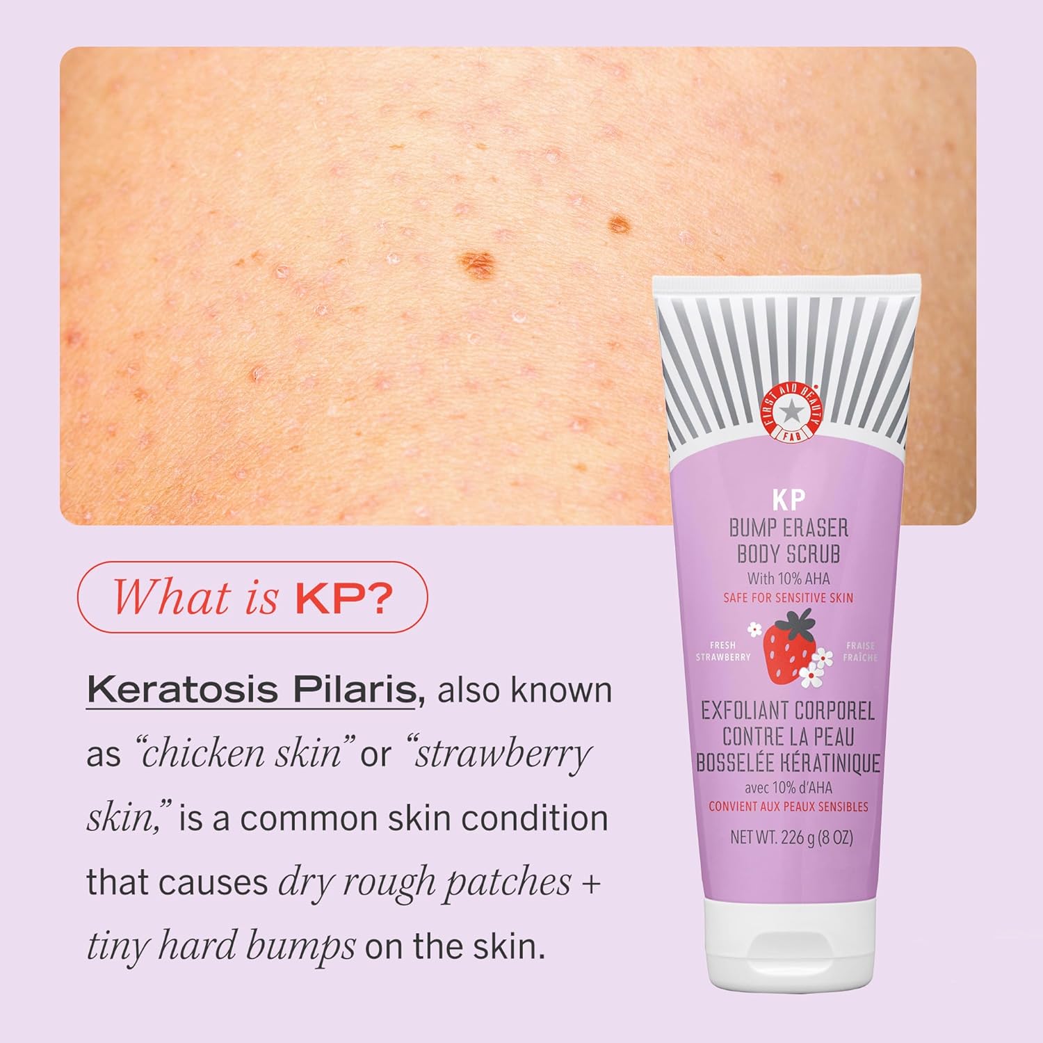 First Aid Beauty - KP Bump Eraser Body Scrub with 10% AHA, Keratosis Pilaris Exfoliating Skin Cleanser with 10% Lactic Acids Glycolic, Pumice & Bisabolol, Reduces Bumps, Strawberry Scent, 2 oz-7