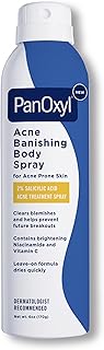 PanOxyl Acne Banishing Body Spray with 2% Salicylic Acid, Pimple Treatment Spray to Clear Stubborn Breakouts, 360-Degree Spray Nozzle, Skin-Brightening Niacinamide, Vitamin C, Witch Hazel, Aloe, 6 Oz